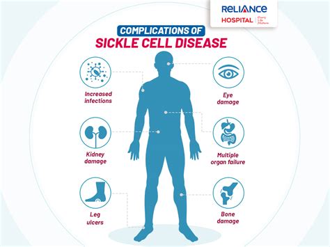 Complications of Sickle Cell Disease