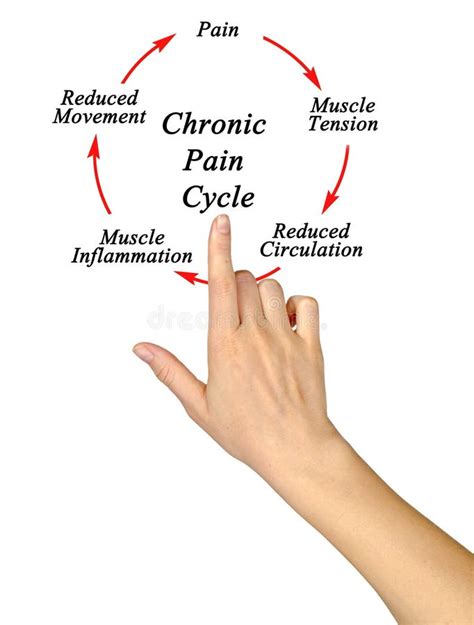 Chronic Pain Cycle stock image. Image of finger, screen - 169534221