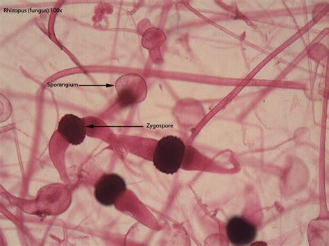 Zygomycota - Dr. Peat's Biology Page