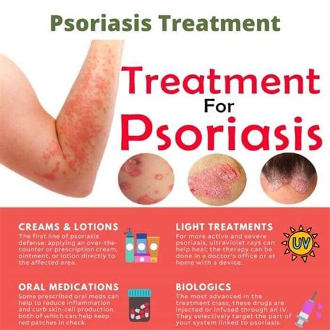 Psoriasis Treatment – Skin Hair and Pain Treatment