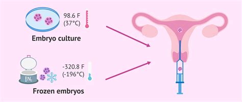 Fresh or frozen embryo transfer