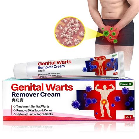 20g Wart Remover Ointment Genital Herpes Genital Antibacterial ...