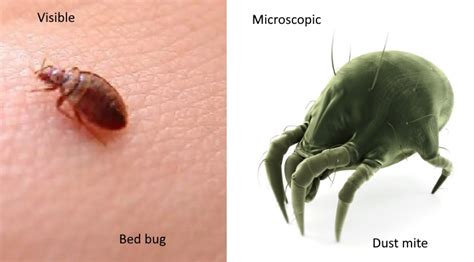 Bed Bug Bites Vs Dust Mites In 7 Points Explained! | Y-L-P-C