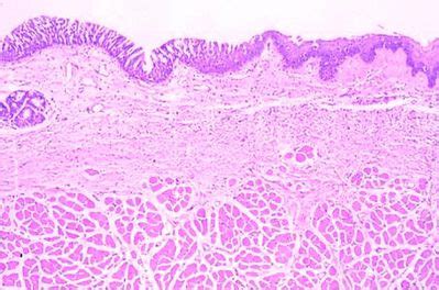 Larynx Histology - Larynx - histology slide