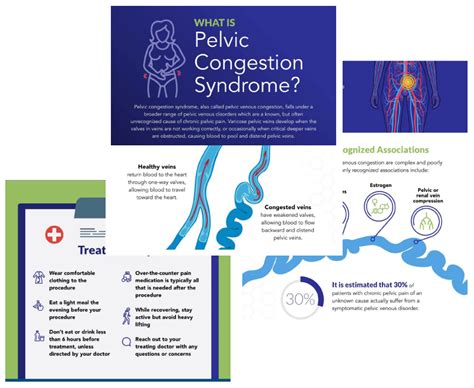 Pelvic Congestion Syndrome Treatment | IVC