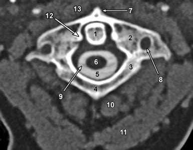 Cervical Spine Anatomy | Radiology Key