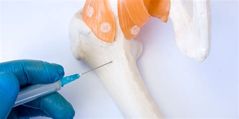 Bone Marrow Biopsy: What is it and What Can it Identify?