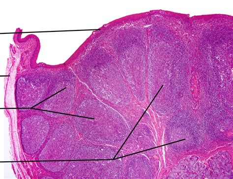 Tonsil Histology Labeled