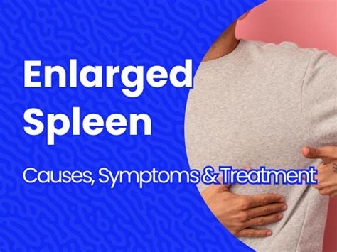 Enlarged Spleen: Causes, Symptoms, and Treatments | Massive Bio