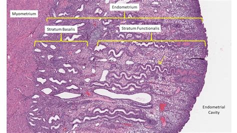 Histology Endometrial Dating – Telegraph