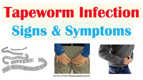 Tapeworm Symptoms