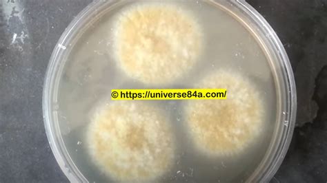 Aspergillus flavus: Introduction, Morphology, Pathogenicity, Lab Diagnosis