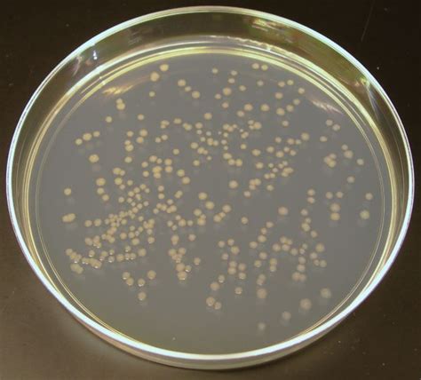 E.coli on nutrient agar | Agar, Plates, Microorganisms