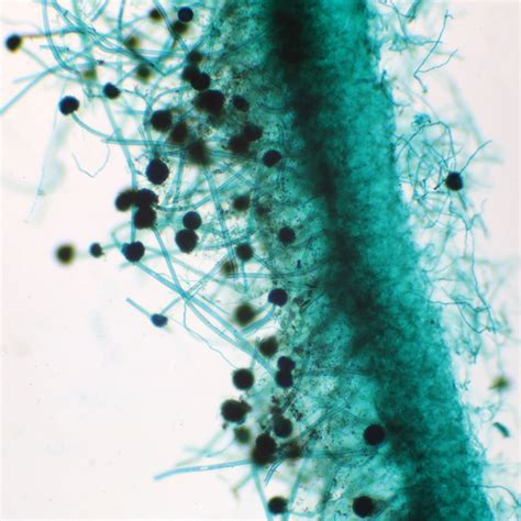 Aspergillus Conidiophores Slide, w.m. | Carolina.com