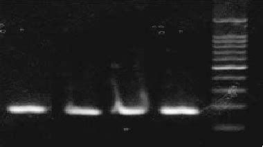 Fig. A 171-bp fragment of the perforin gene including the second extron ...