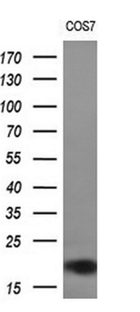 CST2 Antibody (TA504268)