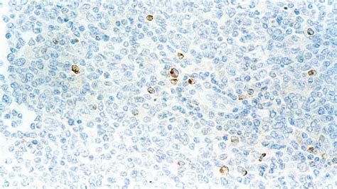 Perforin - IHC Primary Antibodies