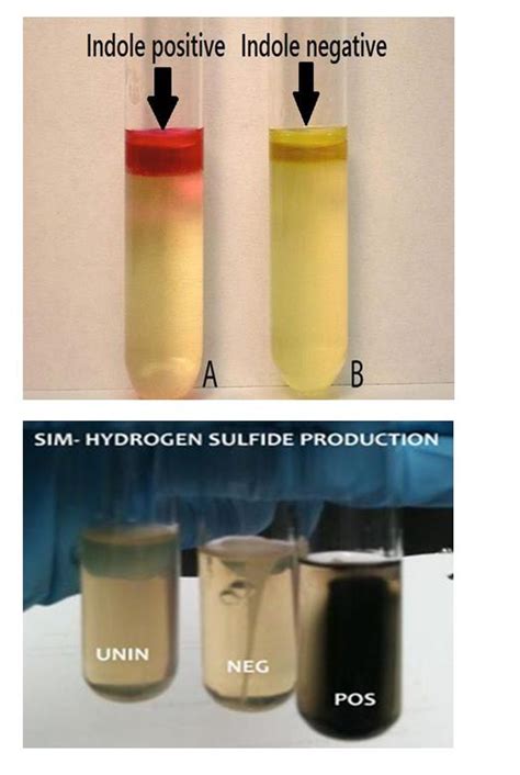 Protocol For Motility, H2S Production & Indole Tests ~ Dhiraj's Blog