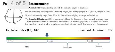 Brachycephaly Cephalic Index Chart: A Visual Reference of Charts ...