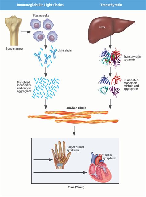 Types Of Amyloidosis