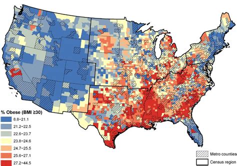 Obesity in the United States