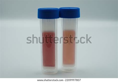 Bacteria Germ Test Tube Identify Bacteria Stock Photo 2209997807 ...