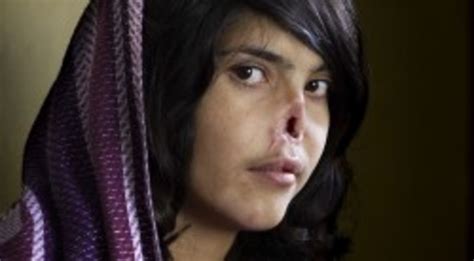 La instantánea de Bibi Aisha, de Jodi Bieber, [i]World Press Photo[/i ...