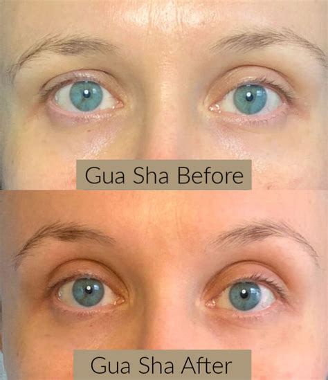 Benefits and Technique for Gua Sha Facial - The Herbal Toad