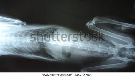 Xray Cats Abdomen Spine Stock Photo 1852437892 | Shutterstock