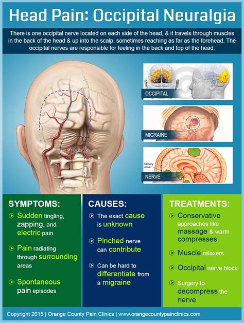 Head Pain Occipital Neuralgia | Occipital neuralgia, Neuralgia, Head pain