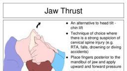 jaw-thrust.jpg - Nursing - Notes - Teachmint