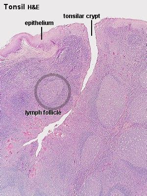 palatine tonsil histology - Google Search | Medical laboratory science ...