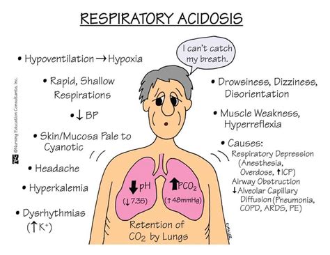 Respiratory Acidosis Nursing Management and Interventions - Nurseslabs