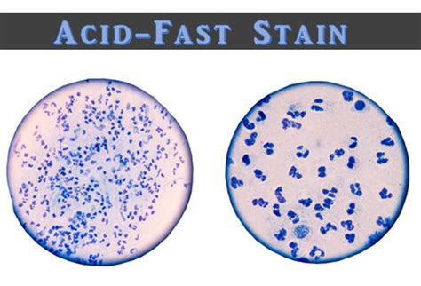 Ex 9 - Acid-Fast Stain - SCIENTIST CINDY