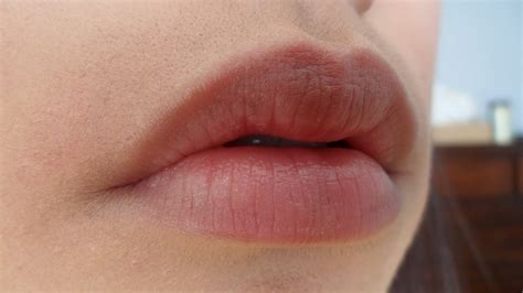 What Does Your Natural Lip Color Say About Your Health? Know Here