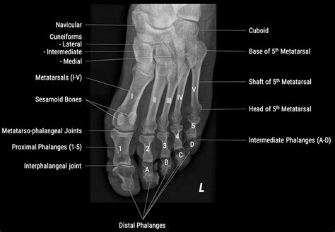 X-Ray Positioning Guide: Toes | Medical Professionals