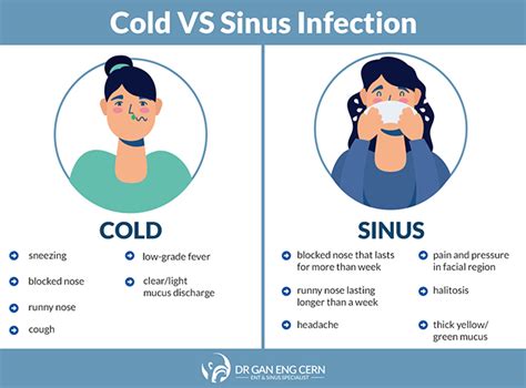 ENT Specialist Singapore | In-Depth Guide To Sinusitis