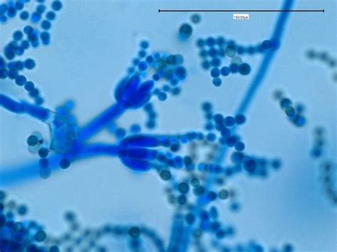 Penicillium Sp. | Microbiology, Medical laboratory science, Animal medicine