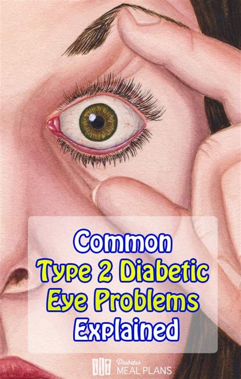 Common Diabetic Eye Problems Explained | Diabetic eye problems, Eyes ...