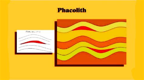 What is Phacolith in Hindi - YouTube