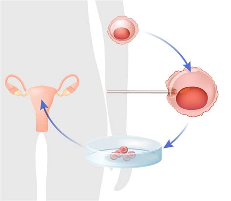 Egg Donation Process - Encino, CA - Bakersfield, CA - Los Angeles, CA ...