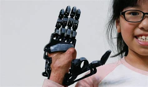 Print your own 3D prosthetic arm! | Hindustan Times