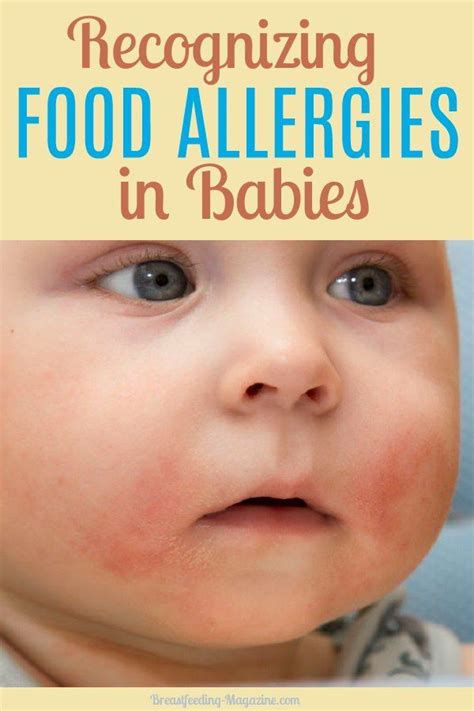 Signs Of Food Intolerance In Babies - BABBIES CIP