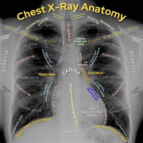 Basic Chest X-Ray Interpretation - Tips and pointers to see it all!