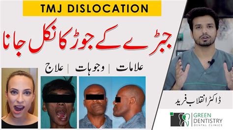 جبڑے کے جوڑ کا اُتر جانا | Jaw Dislocation | Treatment? | जबड़े की ...