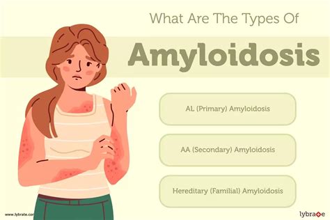 Amyloidosis: Causes, Symptoms, Treatment and Cost