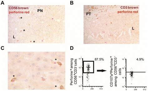 Perforin Antibody (Monoclonal, 5B10)