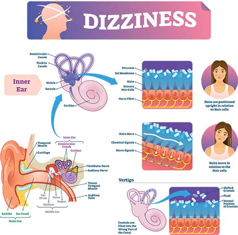 Dizziness (Vertigo) Clinic South Calgary, Calgary AB | Cummings ...