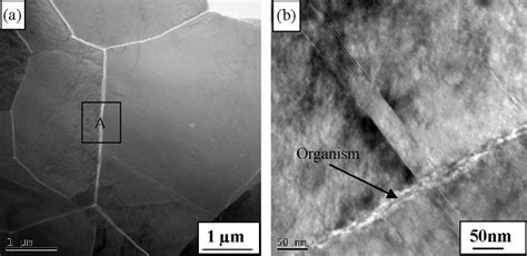 TEM micrograph of the nacre in a face parallel to nacre surface: (a ...