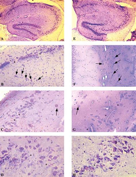 More severe hippocampal atrophy of irradiation and hyperthermia groups ...